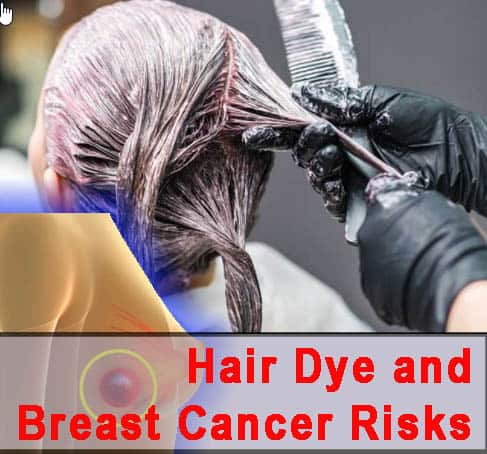 Hair dye and breast cancer Risk