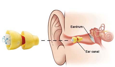 How hearing aids work in hearing loss