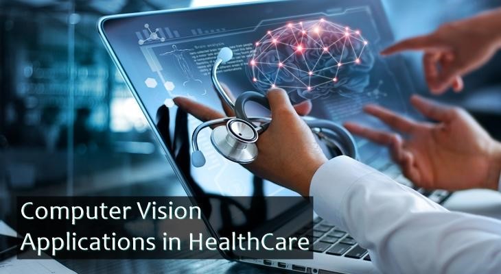 The most helpful uses of Applications of Computer Vision in Healthcare.