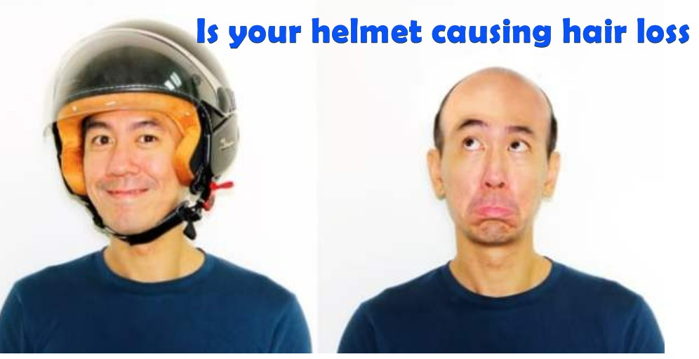 Is your helmet causing hair loss