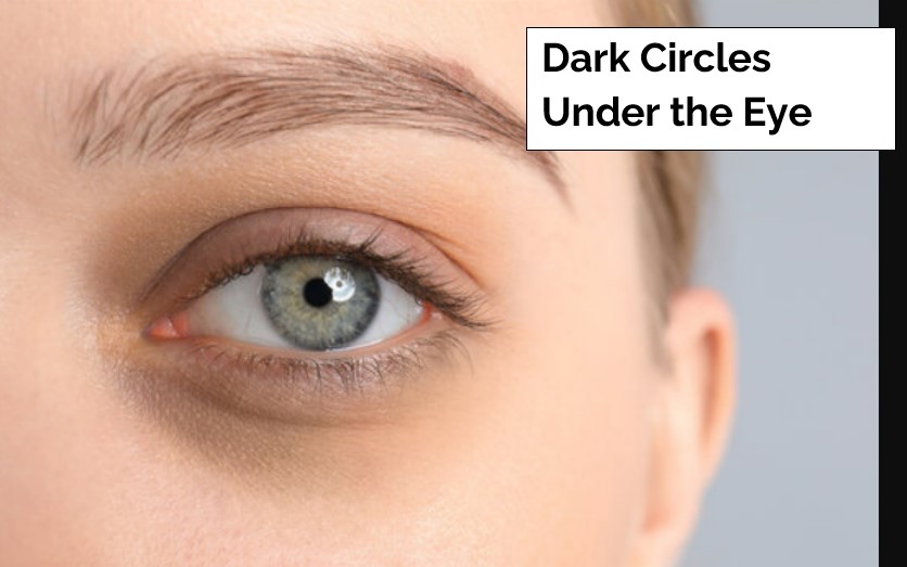 Treat Dark Circles Under the Eye