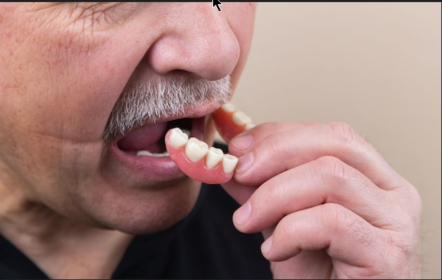 What are the Best Types of Dentures to Get ?