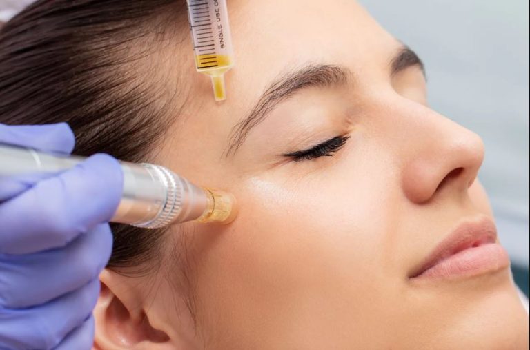 How to Achieve PRP Facial With Glowing Skin in Orlando