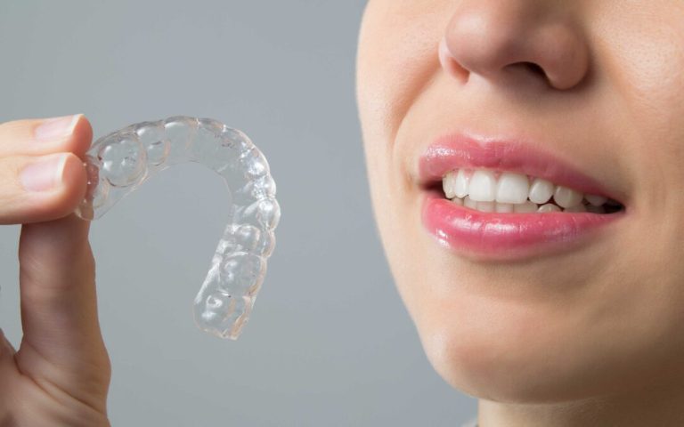Top 5 Invisalign Mistakes People Still Make and How to Avoid Them! 3 Invisalign Mistakes