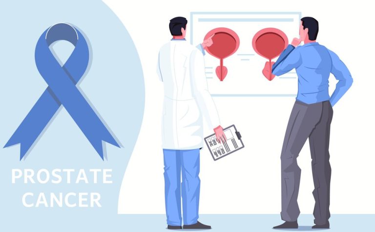 What Happens After Vasectomy