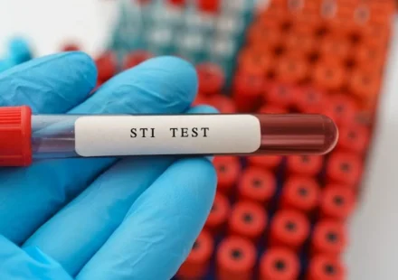 STI Testing Urgent Care