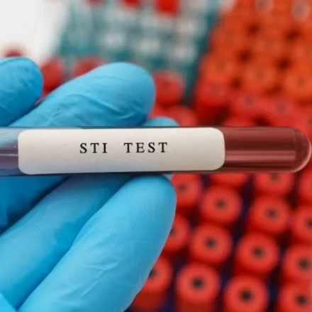 STI Testing Urgent Care