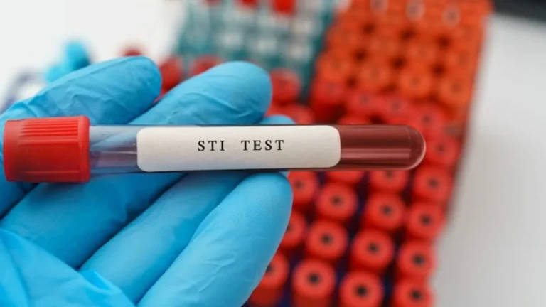 STI Testing Urgent Care