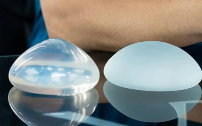 Breast Implant Selection Guide: Implant Types, Sizes, and What Your Adelaide Surgeon Recommends