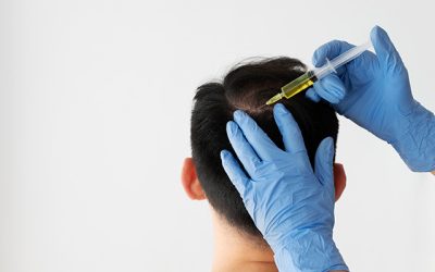 Factors That Influence the Cost of Advanced Hair Restoration Procedures