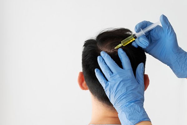 Factors That Influence the Cost of Advanced Hair Restoration Procedures